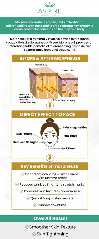 Morpheus8 is a cutting-edge new technology from which people can get more desirable skin quality. Based on the intended outcome and the number of treatments required, the cost of a Morpheus skin treatment may vary. Setting up a consultation with Dr. Eugene J. Liu, M.D., is the best approach to learn the precise cost for your requirements at Aspire Medical Aesthetics. For more information, contact us or schedule an appointment online. We are located at 2 Spencer Pl Suite #9, Scarsdale, NY 10583.