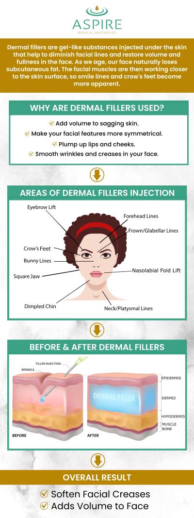 Dermal filler is a cosmetic injectable treatment that involves injecting a gel-like substance beneath the skin to smooth wrinkles, improve volume, and enhance facial features. At Aspire Medical Aesthetics, Eugene J. LIU, M.D., and his experienced team offer a wide range of dermal filler solutions to rejuvenate, enhance and give your face a youthful appearance. Certain areas of the face can be treated with dermal fillers, including lips, cheeks, chin, forehead lines, and more. To keep your skin firm and nourished, contact us or book an appointment online. We have convenient locations to serve you in Scarsdale NY, and New York, NY.
