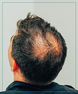 PRF & Gallery at Aspire Medical Aesthetics in Scarsdale and New York, NY