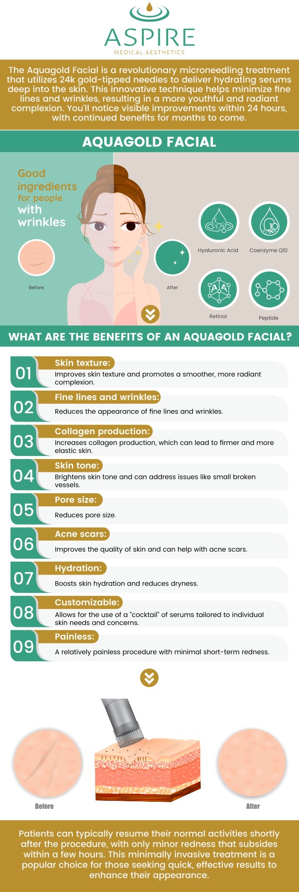 Common questions asked by clients: What is AquaGold microneedling, and how does it work? What skin concerns can AquaGold microneedling treat? How many treatments of AquaGold microneedling are typically needed for optimal results? Is AquaGold microneedling a painless procedure? For more information, contact us or book an appointment online. We have convenient locations to serve you in Scarsdale NY, and New York, NY. We serve clients from Scarsdale NY, New York City NY, Rye Brook NY, Brooklyn NY, Canarsie NY, Larchmont NY, Irvington NY, Glendale Queens NY, and surrounding areas. Common questions asked by clients: What is AquaGold microneedling, and how does it work? What skin concerns can AquaGold microneedling treat? How many treatments of AquaGold microneedling are typically needed for optimal results? Is AquaGold microneedling a painless procedure? For more information, contact us or book an appointment online. We have convenient locations to serve you in Scarsdale NY, and New York, NY. We serve clients from Scarsdale NY, New York City NY, Rye Brook NY, Brooklyn NY, Canarsie NY, Larchmont NY, Irvington NY, Glendale Queens NY, and surrounding areas.