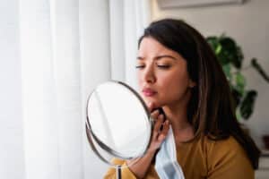Woman looking in the mirror, looking sad about acne scars, needing filler in New York